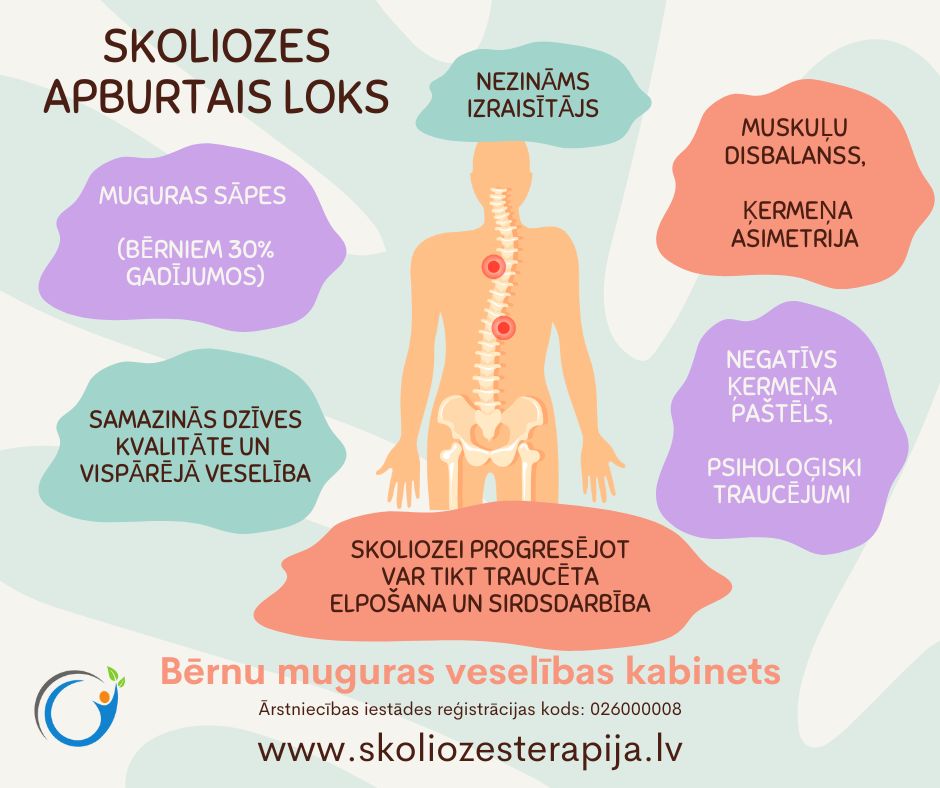 Skoliozes apburtais loks